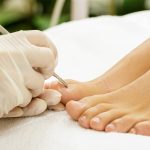 diabetischer_fuss